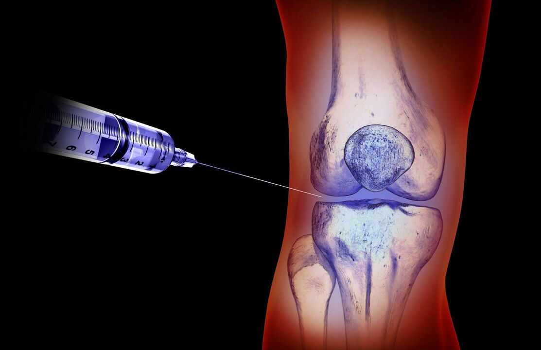 intra-articular injections for joints