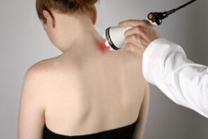 Laser treatment