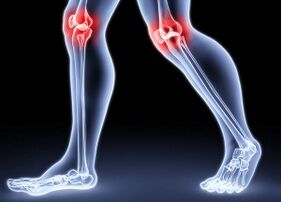 The reasons for the development of knee article