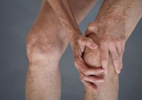 self -mastic knee with arthritis