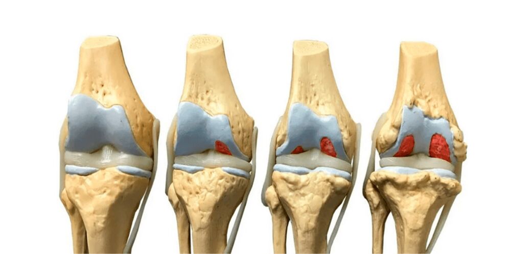 degree of joint articulation